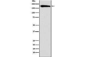 Western blot analysis of SMARCC1 expression in HeLa cell lysate.