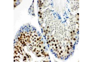 Anti-MCAK antibody, (ABIN3043278), IHC(P)IHC(P): Mouse Testis Tissue (KIF2C Antikörper  (AA 531-725))