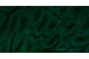 Immunofluorescence (Paraffin-embedded Sections) (IF (p)) image for anti-Selectin P (Granule Membrane Protein 140kDa, Antigen CD62) (SELP) (AA 701-768) antibody (ABIN670131)