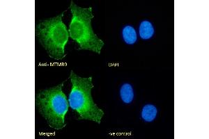 Immunofluorescence (IF) image for anti-Myotubularin Related Protein 9 (MTMR9) (C-Term) antibody (ABIN184635)