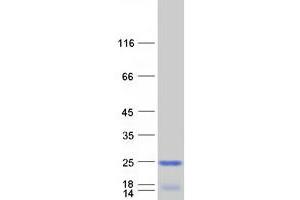 Western Blotting (WB) image for Immature Colon Carcinoma Transcript 1 (ICT1) protein (Myc-DYKDDDDK Tag) (ABIN2723224)