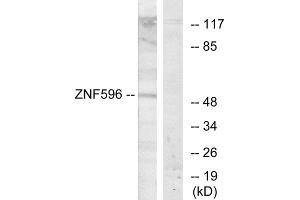 Western blot analysis of extracts from Jurkat cells, using ZNF596 antibody. (ZNF596 Antikörper  (Internal Region))