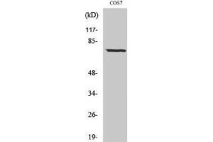 Western Blotting (WB) image for anti-Netrin 1 (NTN1) (C-Term) antibody (ABIN3176270) (Netrin 1 Antikörper  (C-Term))