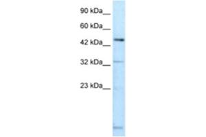 Western Blotting (WB) image for anti-DMRT-Like Family A2 (DMRTA2) antibody (ABIN2460673)