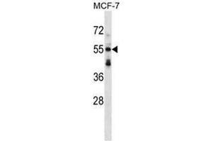 Western blot analysis in MCF-7 cell line lysates (35ug/lane) using Syntrophin-3 / SNTB2 Antibody . (SNTB2 Antikörper  (Middle Region))