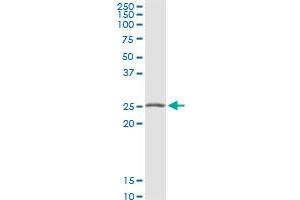 Western Blotting (WB) image for anti-Vesicle Transport through Interaction with T-SNAREs Homolog 1B (VTI1B) (AA 1-232) antibody (ABIN523902)