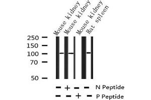 Western blot analysis of Phospho-NF kappaB p105/p50 (Ser932) expression in various lysates (NFKB1 Antikörper  (pSer932))