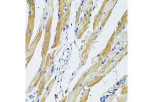 Immunohistochemistry of paraffin-embedded rat heart using GDAP1 antibody (ABIN2562793) at dilution of 1:100 (40x lens).
