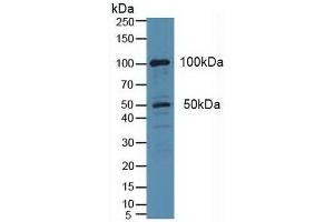 PLA2G4A Antikörper  (AA 1-178)