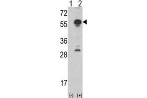 Western Blotting (WB) image for anti-Inhibin, alpha (INHA) antibody (ABIN3002774) (Inhibin alpha Antikörper)