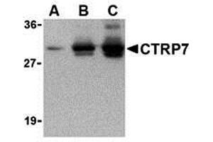 Western Blotting (WB) image for anti-C1q and Tumor Necrosis Factor Related Protein 7 (C1QTNF7) antibody (ABIN1031703) (CTRP7 Antikörper)