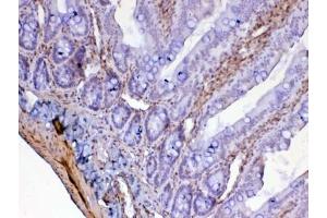 IHC testing of FFPE rat small intestine tissue with Galectin 1 antibody at 1ug/ml. (LGALS1/Galectin 1 Antikörper)