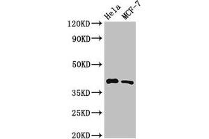 Western Blot Positive WB detected in: Hela whole cell lysate, MCF-7 whole cell lysate All lanes: HLA-B antibody at 3.