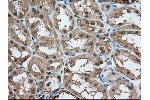 Immunohistochemical staining of paraffin-embedded Human prostate tissue using anti-ACAT2 mouse monoclonal antibody. (ACAT2 Antikörper)