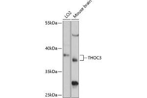 Western blot analysis of extracts of various cell lines, using THOC3 antibody (ABIN6128824, ABIN6149117, ABIN6149118 and ABIN6217153) at 1:3000 dilution.