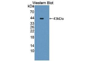 Western blot analysis of the recombinant protein. (JMJD6 Antikörper  (AA 1-334))