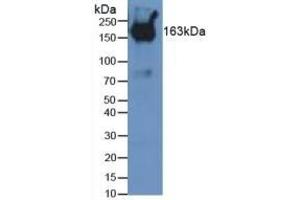 Detection of PZP in Mouse Serum using Polyclonal Antibody to Pregnancy Zone Protein (PZP) (PZP Antikörper  (AA 1224-1495))
