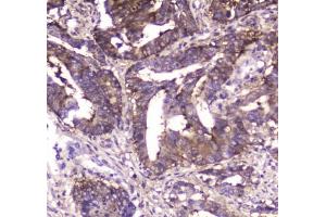 Immunohistochemistry (IHC) image for anti-Major Vault Protein (MVP) antibody (ABIN5708257)