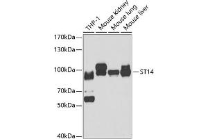 Western blot analysis of extracts of various cell lines, using ST14 antibody (ABIN6132707, ABIN6148517, ABIN6148519 and ABIN6221735) at 1:1000 dilution. (ST14 Antikörper  (AA 566-855))