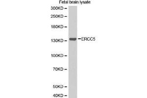 Western Blotting (WB) image for anti-DNA Repair Protein Complementing XP-G Cells (ERCC5) (AA 1-270) antibody (ABIN1512873) (ERCC5 Antikörper  (AA 1-270))