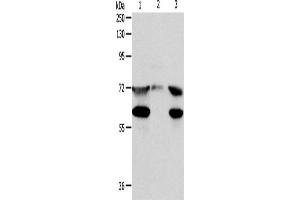 Western Blotting (WB) image for anti-Coiled-Coil Domain Containing 99 (CCDC99) antibody (ABIN2422193)