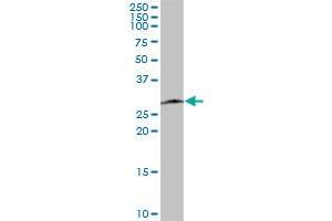 Western Blotting (WB) image for anti-SPC25, NDC80 Kinetochore Complex Component, Homolog (SPC25) (AA 1-224) antibody (ABIN949531)