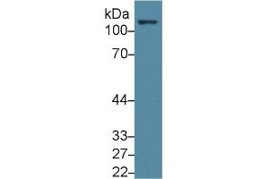 Detection of FAK in Human Jurkat cell lysate using Polyclonal Antibody to Focal Adhesion Kinase (FAK) (FAK Antikörper  (AA 798-1041))