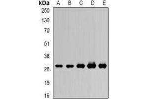 Western blot analysis of RISP expression in SW620 (A), MCF7 (B), mouse heart (C), mouse ovary (D), rat kidney (E) whole cell lysates. (UQCRFS1 Antikörper)