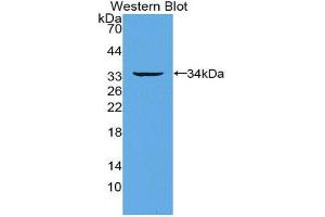 Western Blotting (WB) image for anti-Tumor Necrosis Factor Receptor Superfamily, Member 11a, NFKB Activator (TNFRSF11A) (AA 330-615) antibody (ABIN1860401) (TNFRSF11A Antikörper  (AA 330-615))