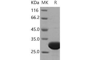 Western Blotting (WB) image for Ubiquitin Carboxyl-terminal Esterase L3 (Ubiquitin Thiolesterase) (Uchl3) (Active) protein (His tag) (ABIN7321219) (UCHL3 Protein (His tag))