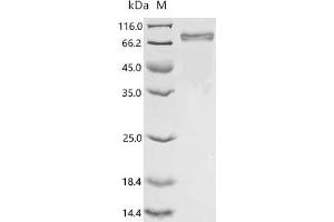 (Tris-Glycine gel) Discontinuous SDS-PAGE (reduced) with 5 % enrichment gel and 15 % separation gel.