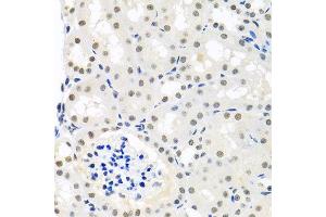 Immunohistochemistry of paraffin-embedded mouse kidney using THOC1 antibody at dilution of 1:100 (x40 lens).