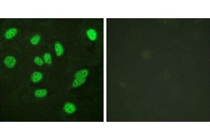 Peptide - +Western blot analysis of extracts from A549 cells, using B-Myb (Ab-577/581) antibody. (MYBL2 Antikörper  (Ser577))
