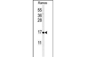 Western blot analysis of CMTM7 Antibody in Ramos cell line lysates (35ug/lane) (CMTM7 Antikörper  (N-Term))