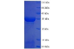 SDS-PAGE (SDS) image for Transforming Growth Factor, alpha (TGFA) (AA 24-97) protein (GST tag) (ABIN5713888)