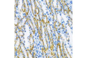 Immunohistochemistry of paraffin-embedded Mouse kidney using DNA Polymerase beta antibody (ABIN3022384, ABIN3022385, ABIN3022386, ABIN1513390 and ABIN1514536) at dilution of 1:100 (40x lens). (POLB Antikörper  (AA 1-335))