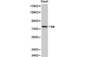 Western Blotting (WB) image for anti-Bruton Agammaglobulinemia tyrosine Kinase (BTK) antibody (ABIN1871367) (BTK Antikörper)