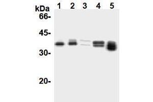 Western Blotting (WB) image for anti-Cyclin D1 (CCND1) antibody (ABIN1106871)