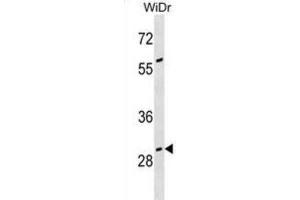 Western Blotting (WB) image for anti-Growth Arrest-Specific 2 (GAS2) antibody (ABIN3000565) (GAS2 Antikörper)