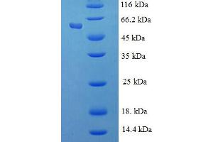 SDS-PAGE (SDS) image for Retinoblastoma Binding Protein 7 (RBBP7) (AA 1-425), (full length) protein (His-SUMO Tag) (ABIN5711301) (RBBP7 Protein (AA 1-425, full length) (His-SUMO Tag))