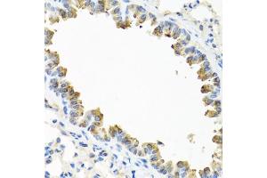 Immunohistochemistry of paraffin-embedded mouse lung using TICAM1 antibody (ABIN6292306) at dilution of 1:100 (40x lens).
