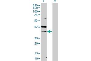 Western Blot analysis of RAB7A expression in transfected 293T cell line by RAB7A MaxPab polyclonal antibody. (RAB7A Antikörper  (AA 1-207))