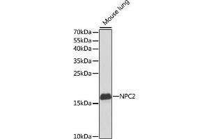 Western blot analysis of extracts of mouse lung, using NPC2 antibody (ABIN6131887, ABIN6144762, ABIN6144763 and ABIN6221063) at 1:1000 dilution.
