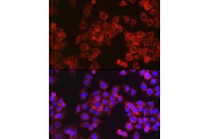 Immunofluorescence analysis of HeLa cells using CPT1A Rabbit pAb (ABIN6130129, ABIN6138976, ABIN6138977 and ABIN6220929) at dilution of 1:100 (40x lens). (CPT1A Antikörper  (AA 497-756))