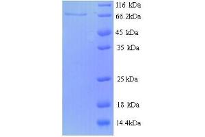 SDS-PAGE (SDS) image for Protein tyrosine Phosphatase, Receptor Type, N Polypeptide 2 (PTPRN2) (AA 28-600) protein (His tag) (ABIN5713772) (PTPRN2 Protein (AA 28-600) (His tag))