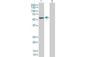 Western Blot analysis of RAD23B expression in transfected 293T cell line by RAD23B MaxPab polyclonal antibody. (RAD23B Antikörper  (AA 1-409))