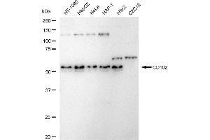 Western blotting analysis using CD102 antibody (ABIN7799078).