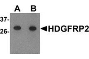 Western blot analysis of HDGFRP2 in human testis tissue lysate with HDGFRP2 antibody at (A) 0. (HDGFRP2 Antikörper  (N-Term))