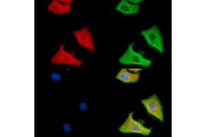 C12orf29 Antibody staining HepG2 cells by IF/ICC. (C12ORF29 Antikörper)