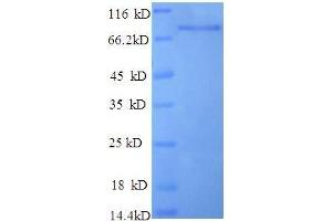 SDS-PAGE (SDS) image for Enolase 1 (ENO1) (AA 2-428), (partial) protein (GST tag) (ABIN1608199)